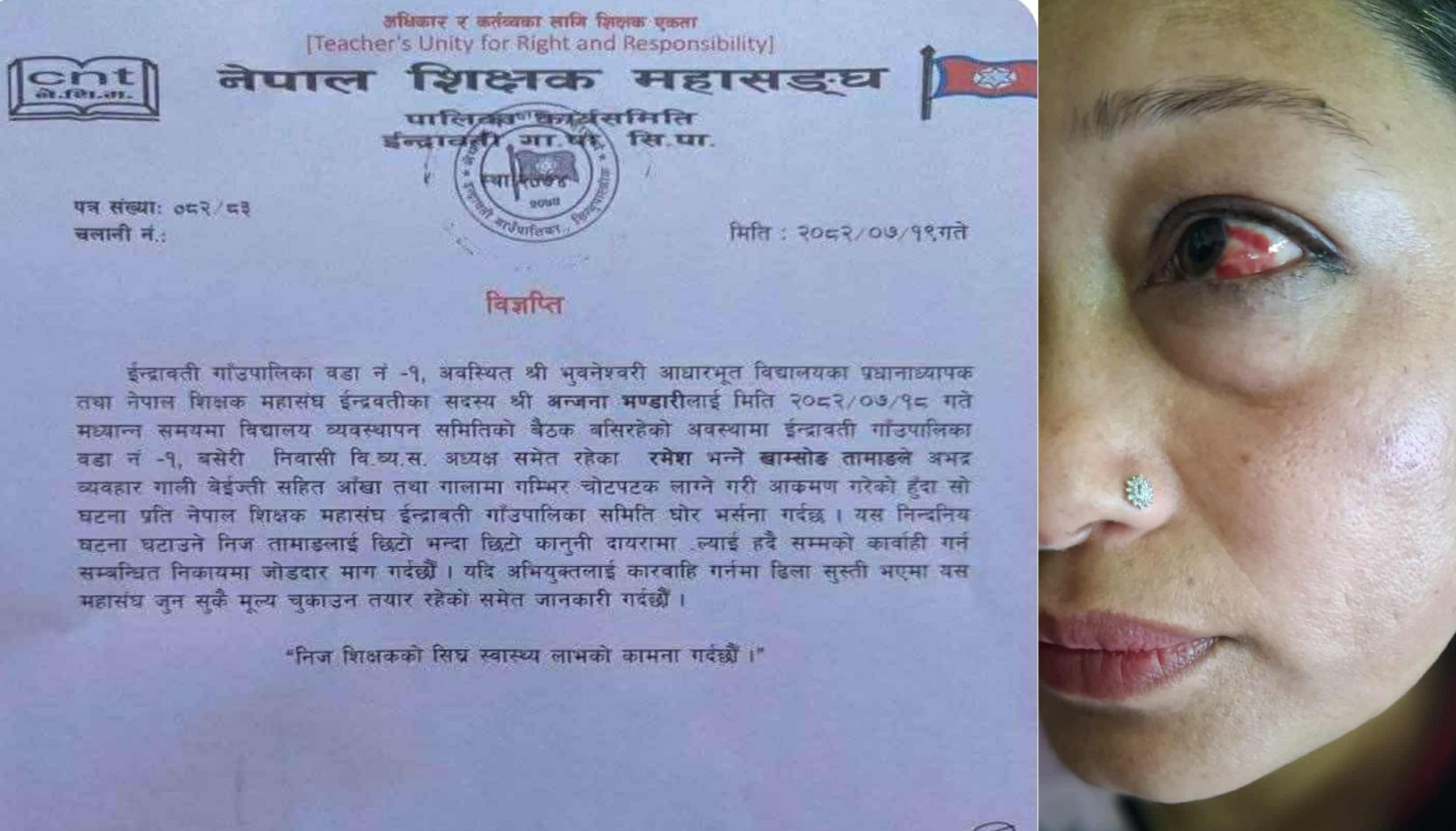 बिब्यस अध्यक्षद्वारा प्रधानाध्यापक कुटिए, घटनाको चौतर्फी विरोध